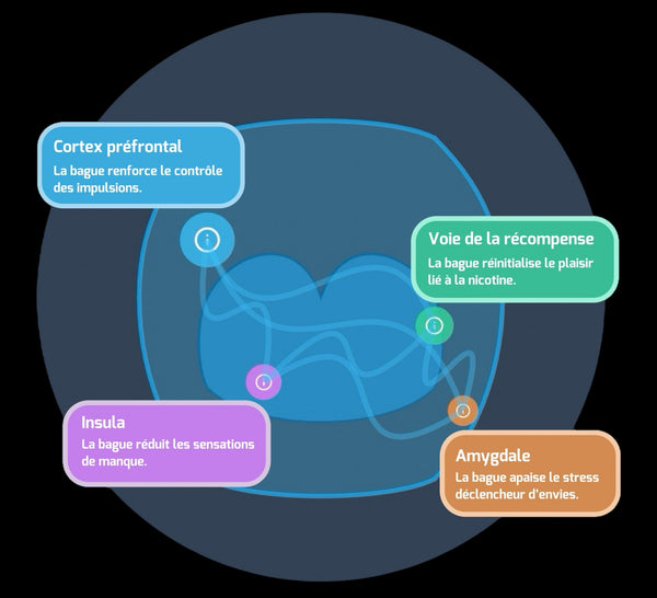 Image Après